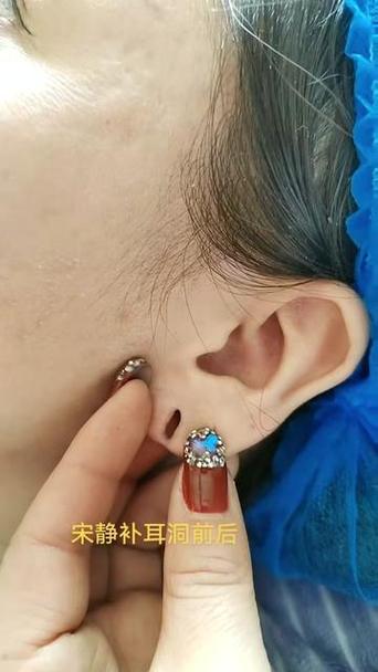 带耳机会使耳洞变大吗