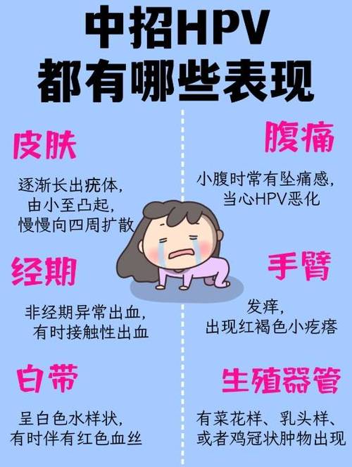 系统感染病毒的原因