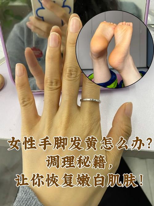 手发黄是怎么回事女性