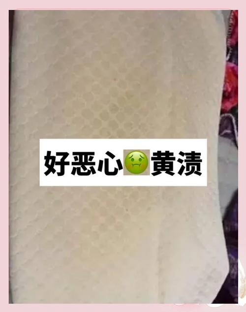 白床单发黄怎么洗干净