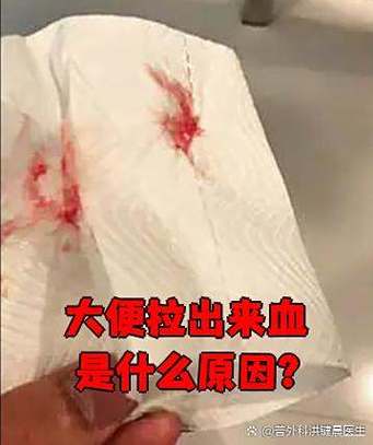 缩小变成姨妈屁股里的屎