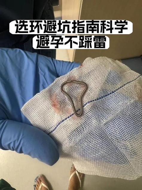 不想带安全套,又怕怀孕怎么办