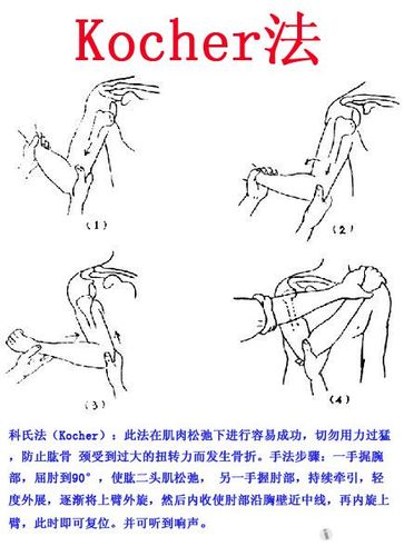 脱臼如何复位