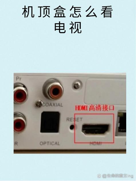 机顶盒怎么连接2台电视图标