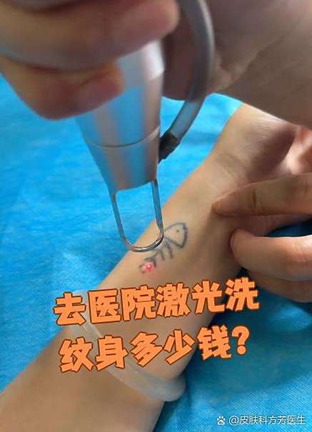 去医院洗纹身多少钱图标