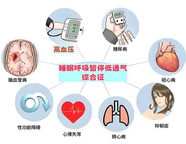 呼吸暂停一般寿命