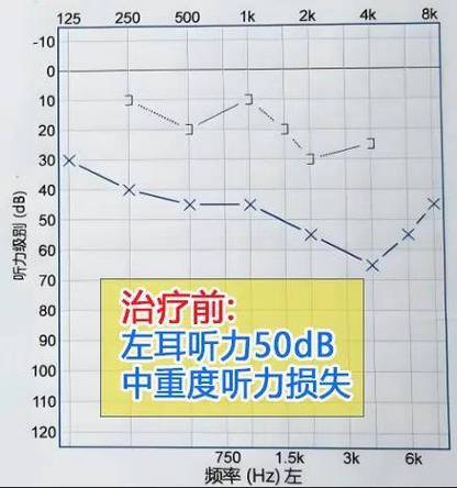 苹果耳机只有一只耳机有声音