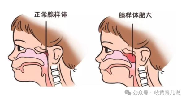 一直上火降不下来是什么原因