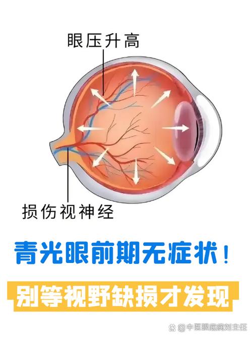 视野缺损自己能感觉吗